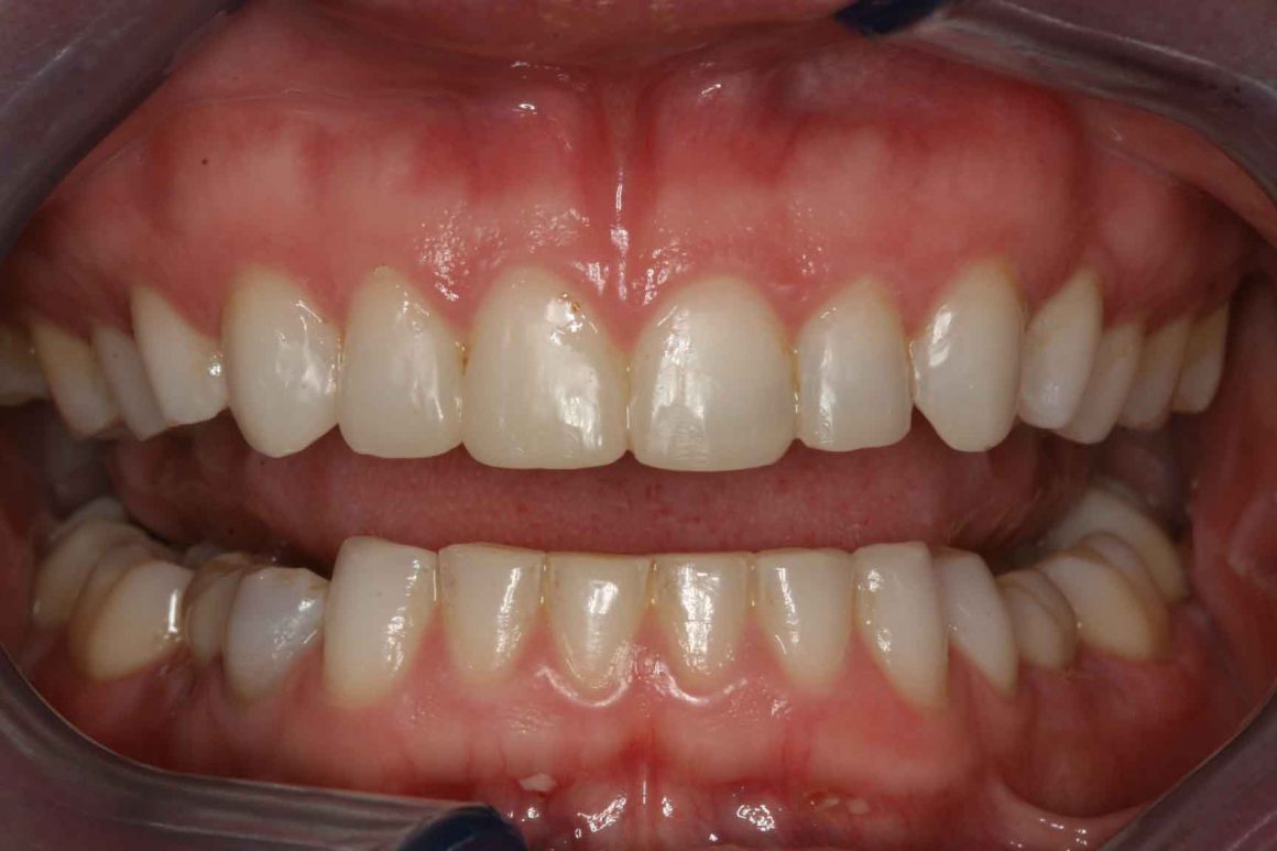 uneventeethedges Time Dental