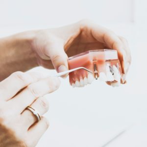 dental-implant-in-farnham-demo