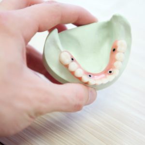 implant-retained-denture-farnham